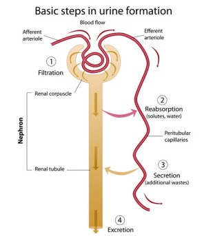 Laparoendoscopic Single-Site Surgery (LESS) for Repair of the Ureteropelvic Junction by OrangeCountySurgeons